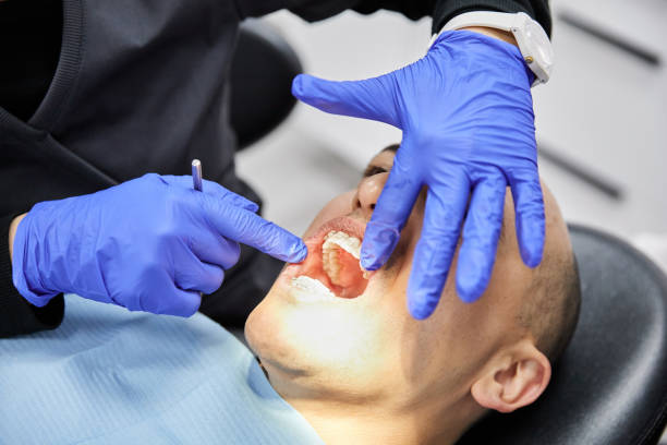 Best Emergency Wisdom Teeth Removal in Sellersville, PA